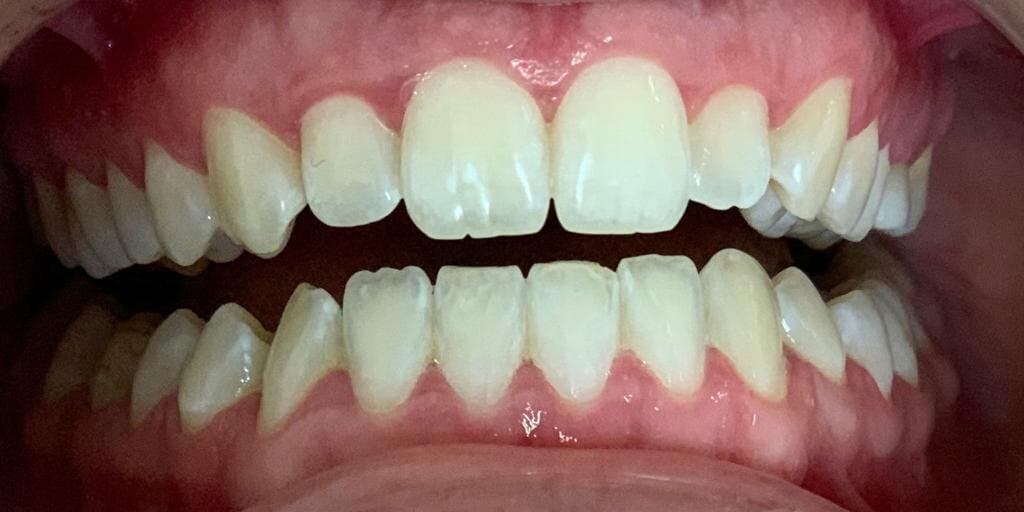 After